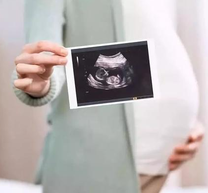 怀孕35天双胞胎b超图解分享，是同卵还是异卵一看就明白