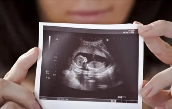 孕7周做b超胎心高是男孩还是女孩的几率大一点呢？