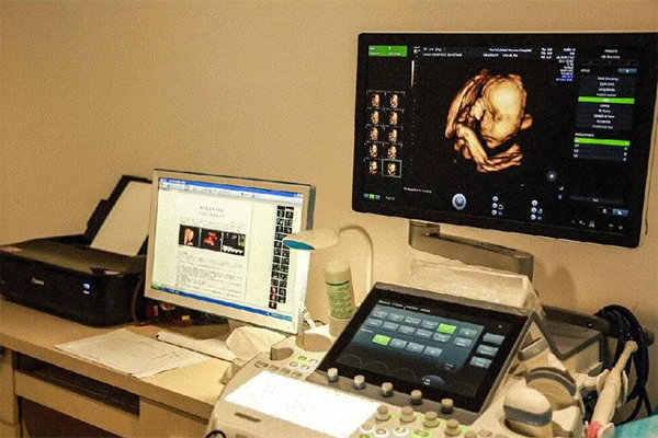 四维彩超看胎儿性别的方法介绍，这样看生殖器官比较准