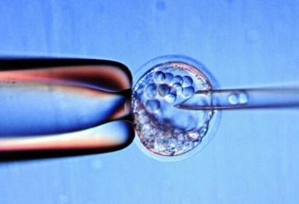 50岁坚持二代试管备孕移植几个胚胎好？