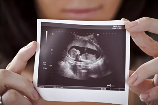 怀孕三个月男宝亮点正面图是什么样子的？