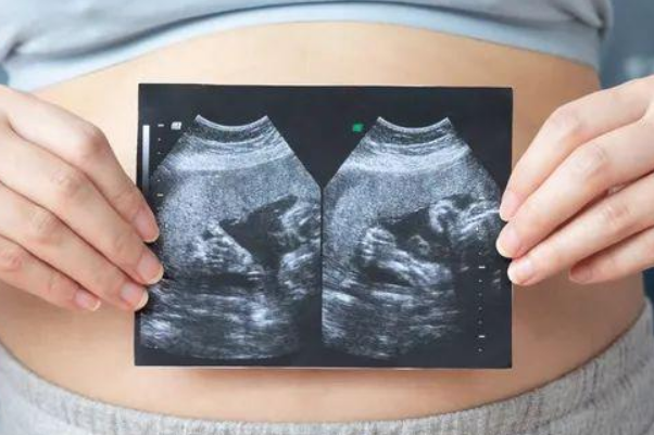 怀单卵双胞胎多长时间后孕妈容易出现胎停呢？