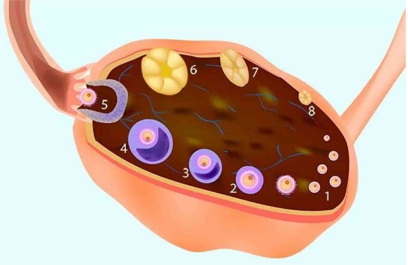 详解多囊试管卵泡不成熟的表现，直径通常会小于18