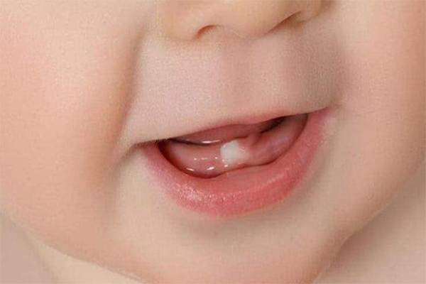 孩子单出牙是很正常的