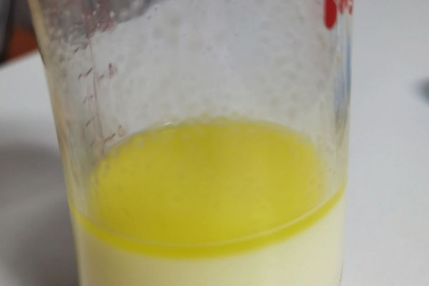 母乳解冻之后出现的黄色油脂和沉淀物是什么？