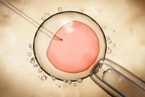 第三代试管婴儿胚胎移植的费用高不高？