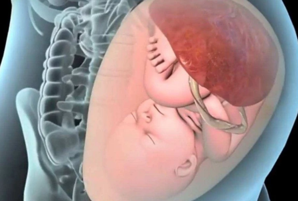 胎位不正纠正不了的胎儿生出来之后是不是不聪明？