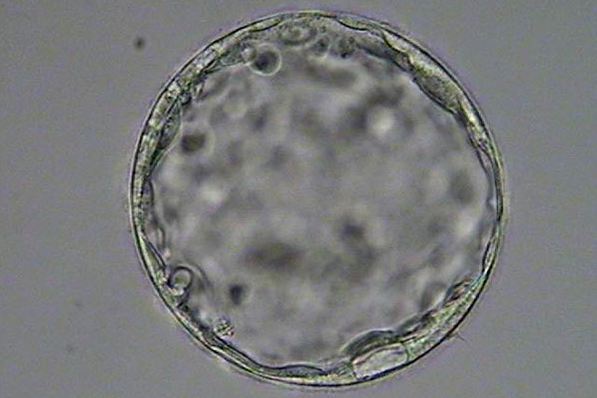 4bb胚胎解冻后为什么胚胎质量还会升级成6bb？